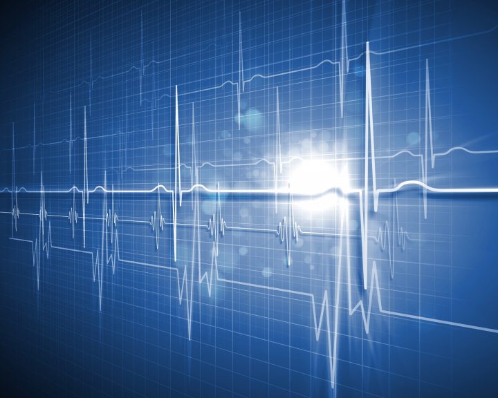 heartbeat